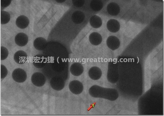 BGA因?yàn)楹笁|變小，造成錫膏過多而最終形成焊接短路的結(jié)果。