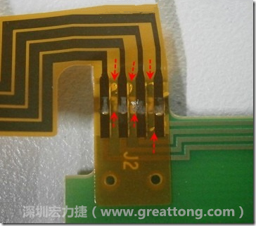 這張圖所顯示的，PCBA工廠實際進行HotBar(熱壓熔錫焊接)焊接的時候，經(jīng)常會出現(xiàn)這類焊墊之間短路的問題，下面的圖示為比較嚴重的案例，大部分都只有部份溢錫，但這對品質(zhì)信賴杜已經(jīng)產(chǎn)生了及大的為害，既使現(xiàn)在測試沒有出現(xiàn)問題，難保在高溫膏濕的環(huán)境下不會出現(xiàn)電子遷移(Electromigration)的現(xiàn)象。